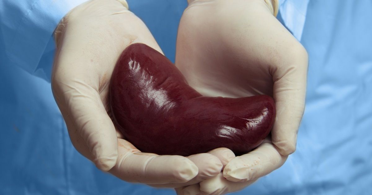 kidney transplant - newsodin